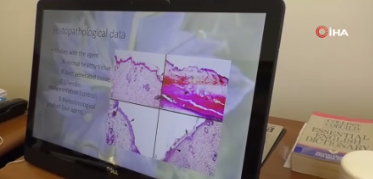 Foto - Tıp dünyasını heyecanlandıran krem! Erzurum'da geliştirilip yaşlı kadında denendi... Sonuç herkesi hayrete düşürdü