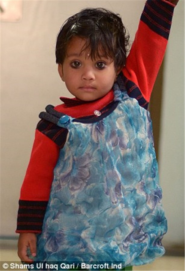 Foto - Tıp dünyasını şaşırtan olay!