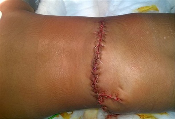 Foto - Tıp dünyasını şaşırtan olay!