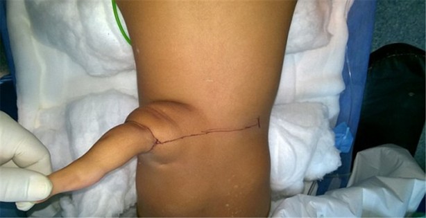 Foto - Tıp dünyasını şaşırtan olay!