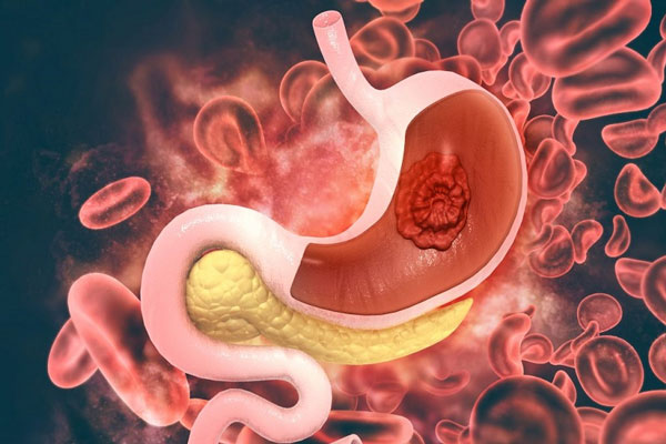 Foto - Tıpta çığır açan teknoloji! Artık yapay zeka ile tespit edilebilecek