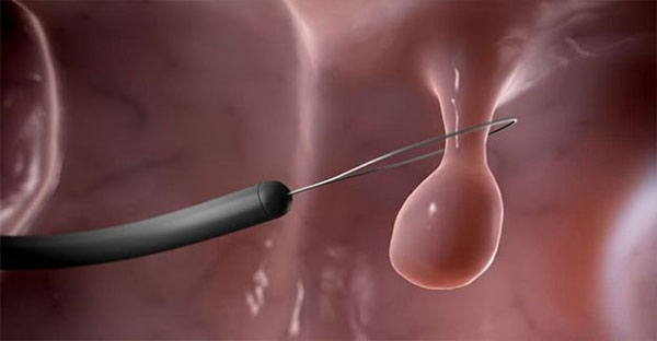 Foto - Tıpta çığır açan teknoloji! Artık yapay zeka ile tespit edilebilecek