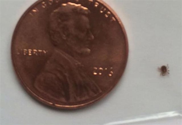 Foto - Tırnağındaki siyah noktadan şüphelendi! Bakın ne çıktı...