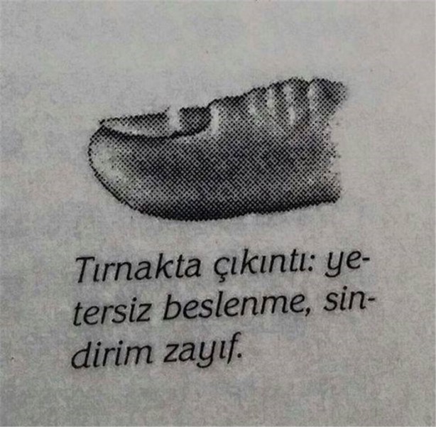 Foto - Tırnağınız hastalığınızın habercisi olabilir