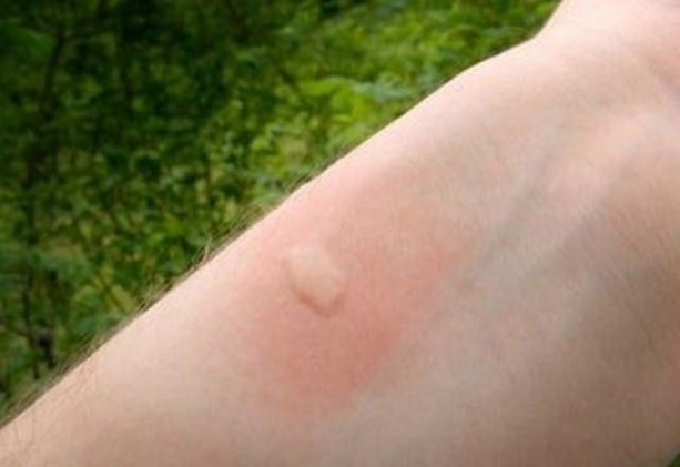 Tırnağınıza diş macunu sürerseniz...