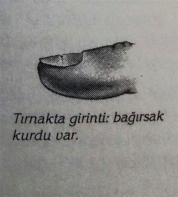 Foto - Tırnağınızın şekli hastalıklarınızı gösteriyor