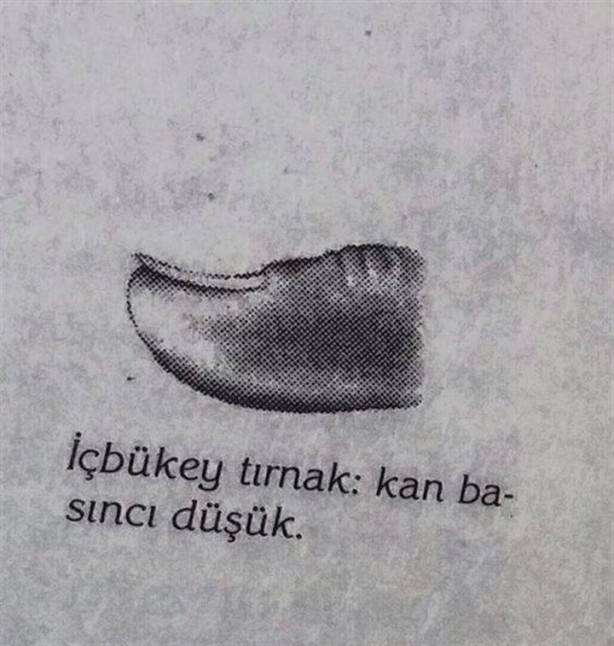 Foto - Tırnağınızın şekli hastalıklarınızı gösteriyor