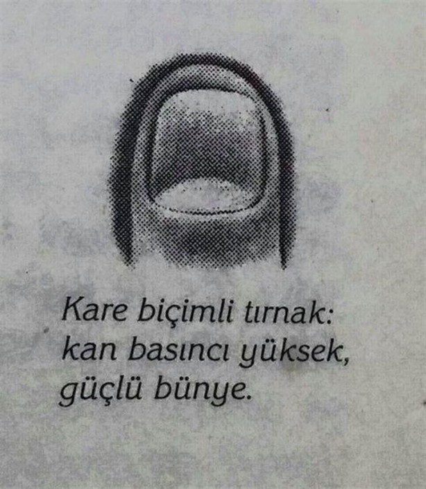 Foto - Tırnağınızın şekli hastalıklarınızı gösteriyor