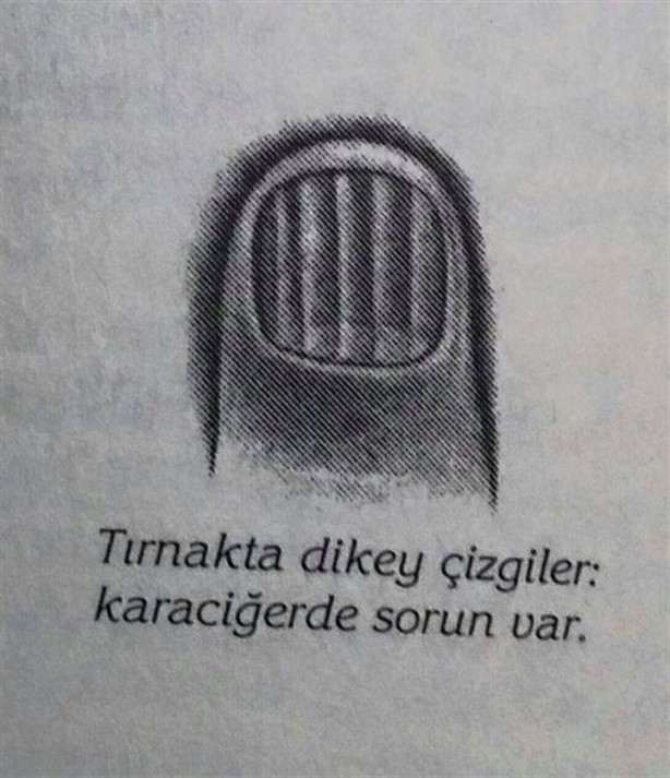 Foto - Tırnağınızın şekli hastalıklarınızı gösteriyor