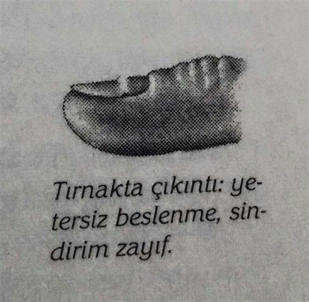 Foto - Tırnağınızın şekli hastalıklarınızı gösteriyor