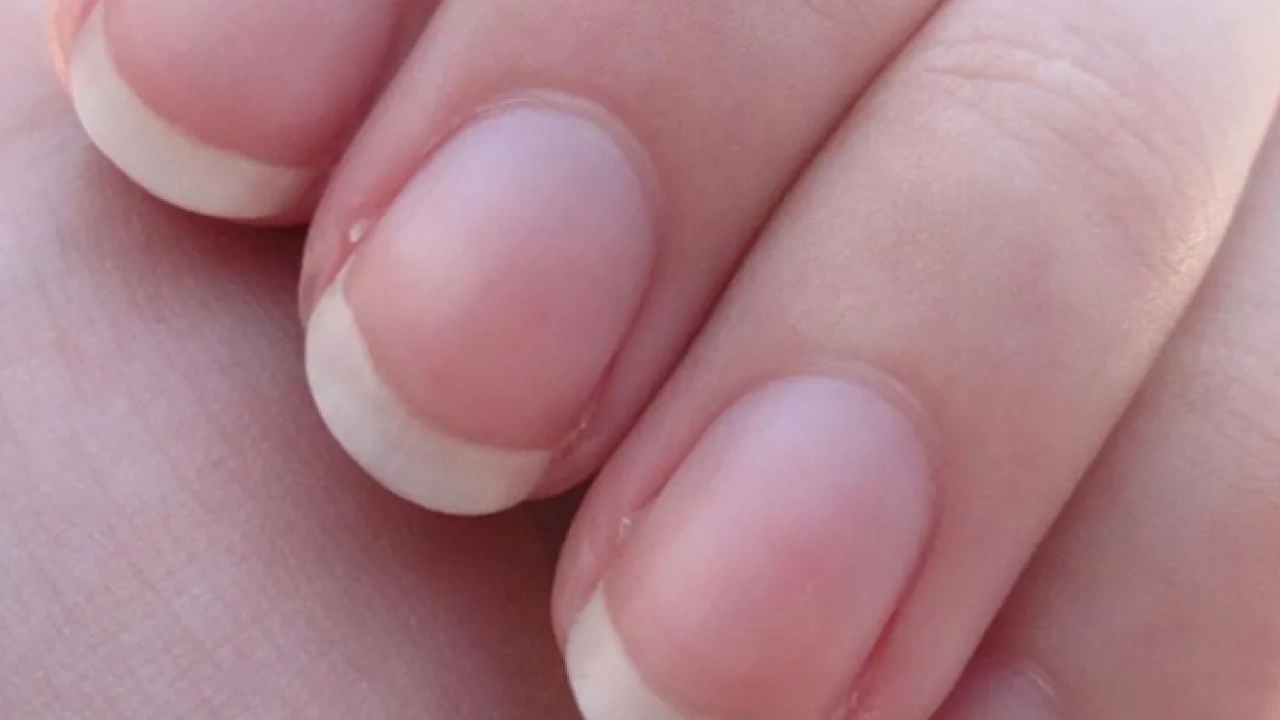Foto - Tırnak diplerine dikkat! Eğer öyleyse bakın hangi hastalıkların habercisiymiş: Dibinden değiştiriyor! Öyle bir tehlikesi var ki...