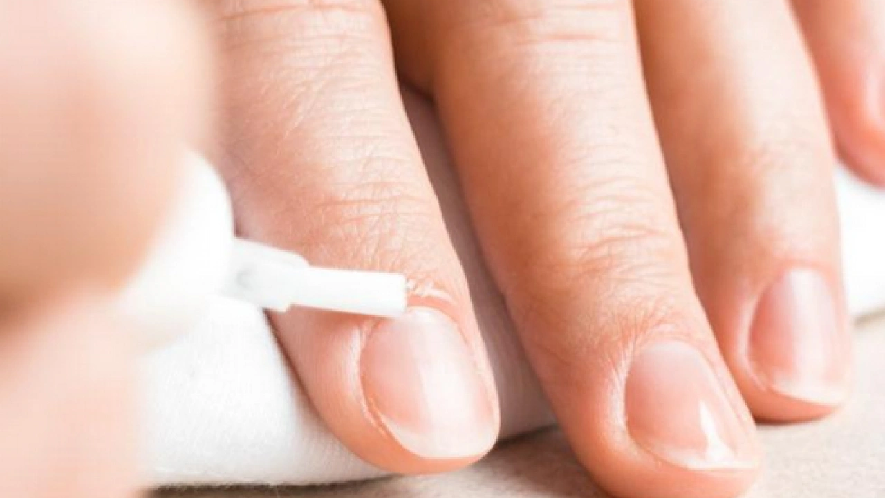 Foto - Tırnak diplerine dikkat! Eğer öyleyse bakın hangi hastalıkların habercisiymiş: Dibinden değiştiriyor! Öyle bir tehlikesi var ki...