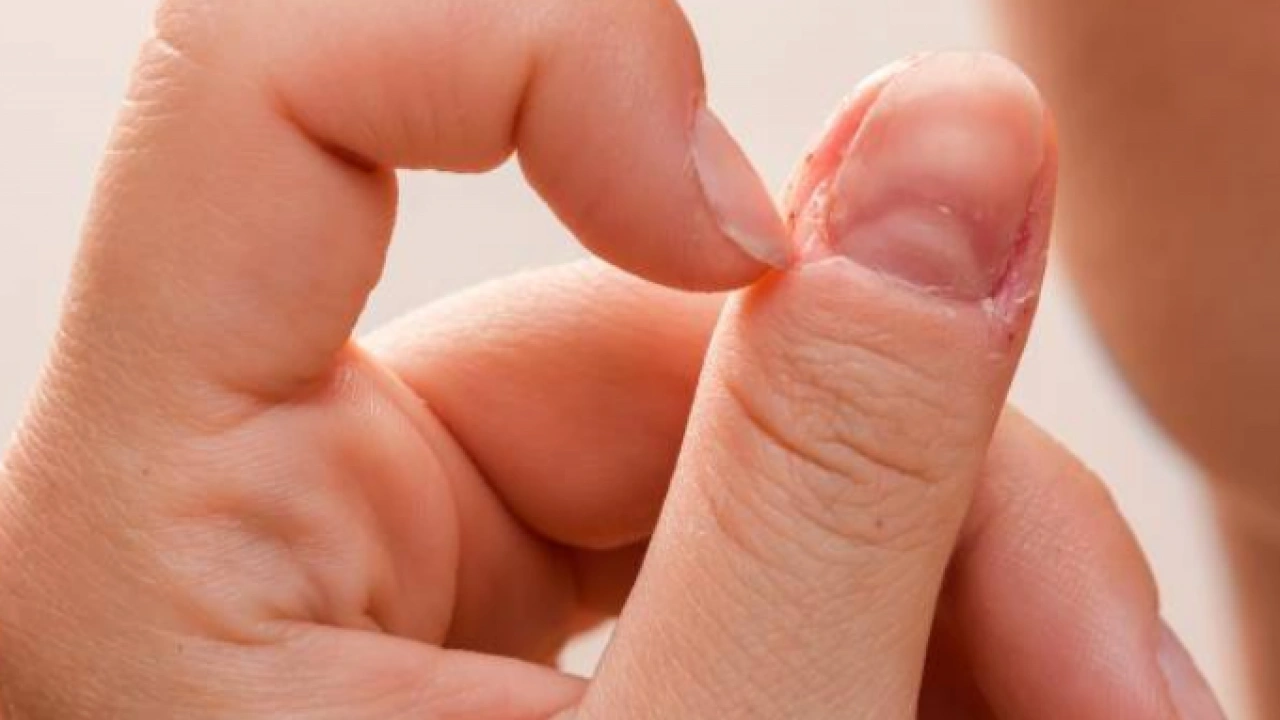 Foto - Tırnak diplerine dikkat! Eğer öyleyse bakın hangi hastalıkların habercisiymiş: Dibinden değiştiriyor! Öyle bir tehlikesi var ki...