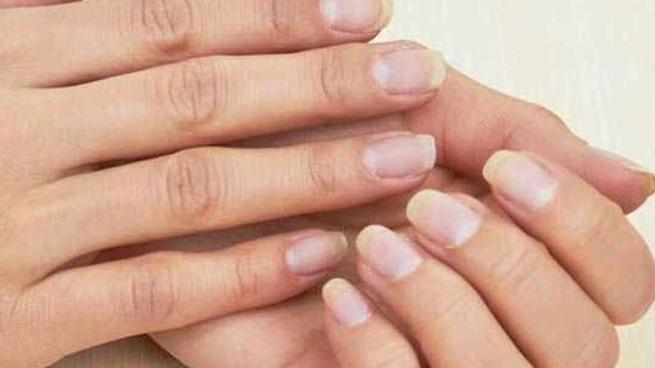 Foto - Tırnak diplerine dikkat! Eğer öyleyse bakın hangi hastalıkların habercisiymiş: Dibinden değiştiriyor! Öyle bir tehlikesi var ki...