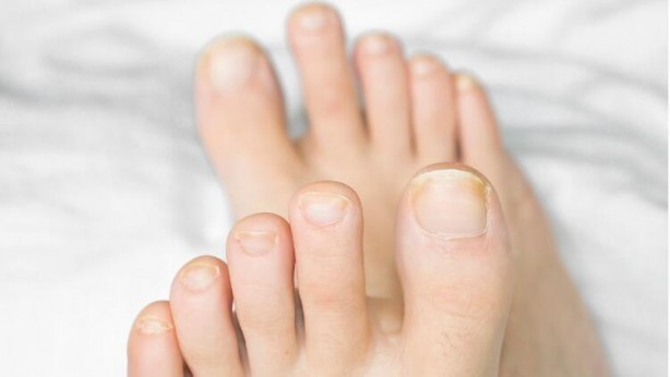 Foto - Tırnak rengindeki değişikliği hafife almayın