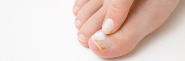 Foto - Tırnak rengindeki değişikliği hafife almayın