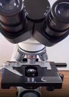 Foto - Tırnak yiyenler bir daha elini ağzına götürmeyecek! Mide bulandıran görüntü