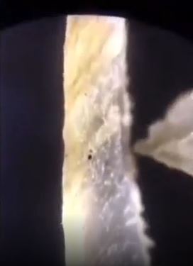 Foto - Tırnak yiyenler bir daha elini ağzına götürmeyecek! Mide bulandıran görüntü