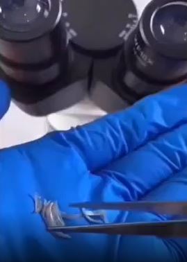 Tırnak yiyenler bir daha elini ağzına götürmeyecek! Mide bulandıran görüntü