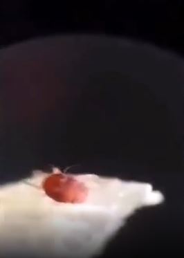 Foto - Tırnak yiyenler bir daha elini ağzına götürmeyecek! Mide bulandıran görüntü