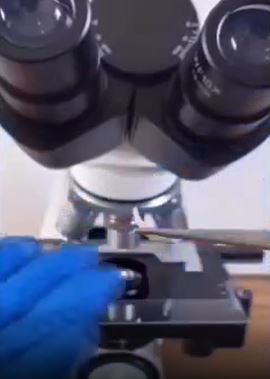 Foto - Tırnak yiyenler bir daha elini ağzına götürmeyecek! Mide bulandıran görüntü