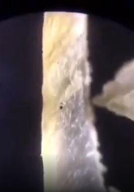 Foto - Tırnak yiyenler bir daha elini ağzına götürmeyecek! Mide bulandıran görüntü