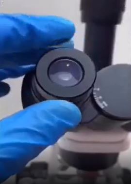 Foto - Tırnak yiyenler bir daha elini ağzına götürmeyecek! Mide bulandıran görüntü