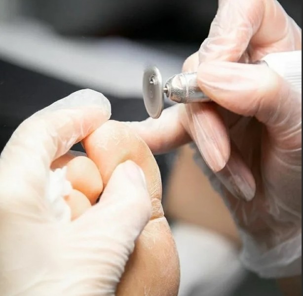 Foto - Tırnaklar nasıl kesilmeli! Uzmanlar uyardı