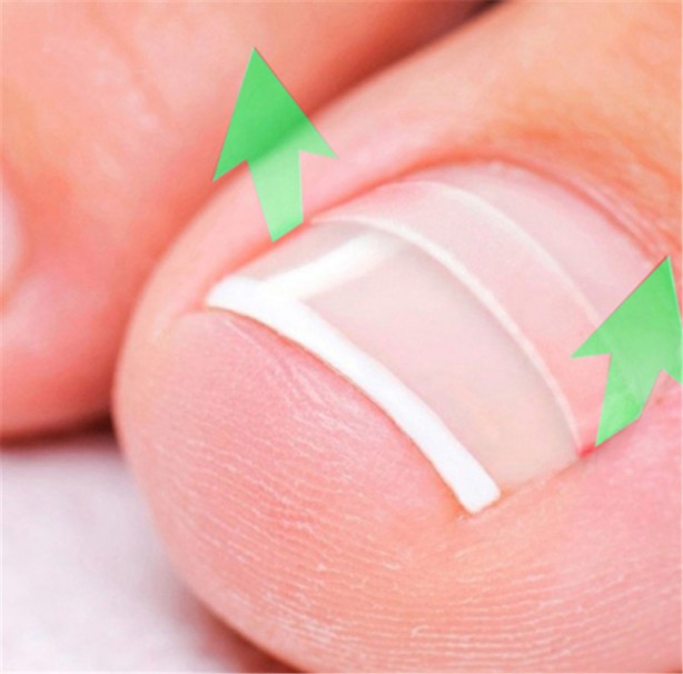 Foto - Tırnaklar nasıl kesilmeli! Uzmanlar uyardı