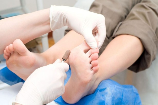 Foto - Tırnaklar nasıl kesilmeli! Uzmanlar uyardı