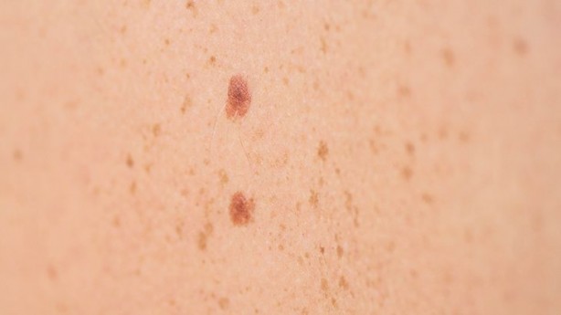 Foto - Tırnaklardaki bu beklenmedik belirti eğer böyle varsa aman dikkat, durum ciddi! Herkes konuşuyor