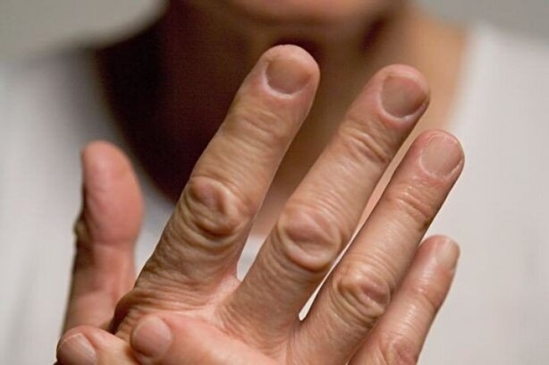 Foto - Tırnaklardaki bu belirti hastalık habercisi olabilir