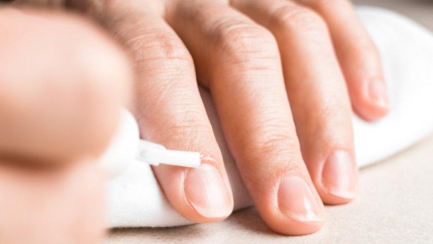 Foto - Tırnaklardaki bu belirti hastalık habercisi olabilir