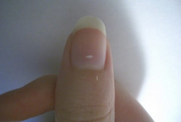 Foto - Tırnaklarınızda beyaz leke varsa dikkat!