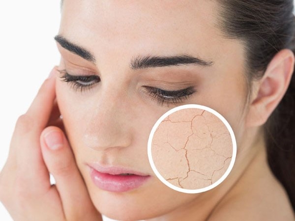 Foto - Tırnaklarınızda beyaz lekeler varsa, dikkat!