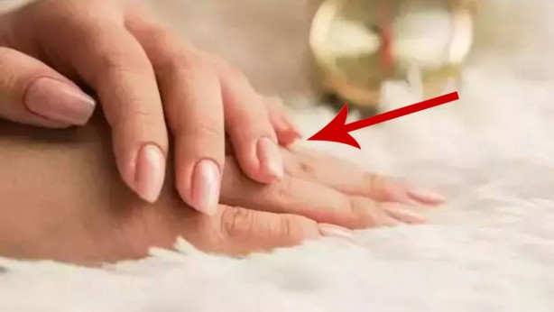 Tırnaklarınızı hemen kontrol edin! Eğer bunlar varsa yandınız: O hastalığın habercisi olabiliyor