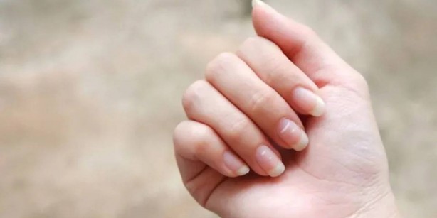 Foto - Tırnaklarınızı hemen kontrol edin! Eğer bunlar varsa yandınız: O hastalığın habercisi olabiliyor