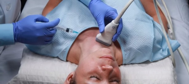 Foto - Tiroid bozukluğunun erken belirtileri