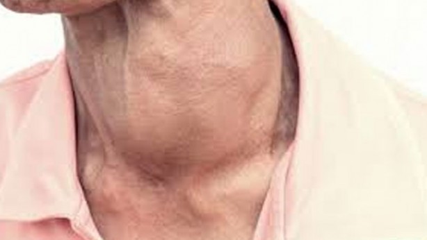 Foto - Tiroid hastalıklarının sessiz belirtileri