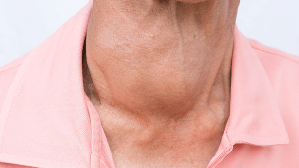 Foto - Tiroid hastalıklarının sessiz belirtileri