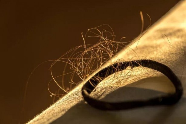 Foto - Tomar tomar dökülen saç görmeye son veren yöntem! Saçlarınızı çelik gibi yapıyor