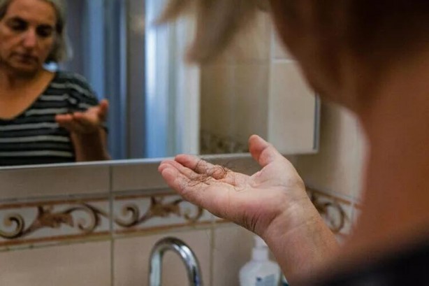 Foto - Tomar tomar dökülen saç görmeye son veren yöntem! Saçlarınızı çelik gibi yapıyor