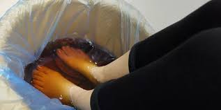 Foto - Topuk dikenine karşı denenmiş doğal yöntemler: Herkes bakın ne yaptı: Çözüm önerileri damgasını vurdu