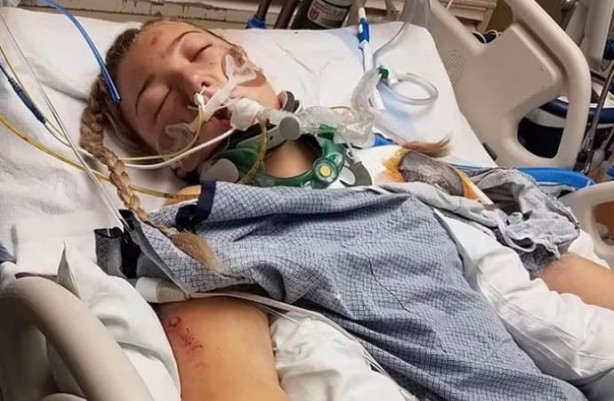 Foto - Trafik kazasında arabadan fırlayan kadın elektrik direğinde böyle asılı kaldı! İşte şok eden anlar