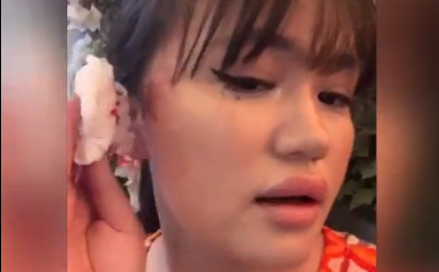 Foto - Tramvayda artistlik yapan turist kafayı öyle bir vurdu ki! Neye uğradığını şaşırdı