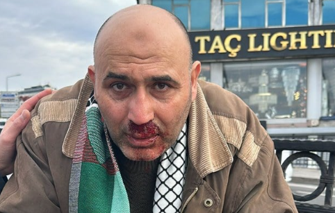 Foto - Tuğçe Kazaz, 'Hilafet bayrağı açan adama saldıran gence söyleyin' diyerek seslendi: 2030'a kadar bu olacak