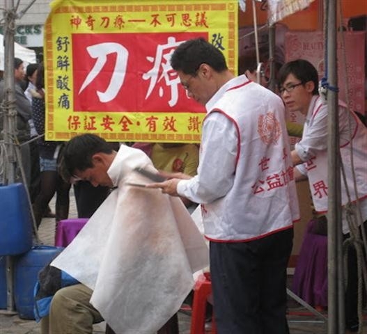 Foto - Tuhaf tedavi yöntemleri