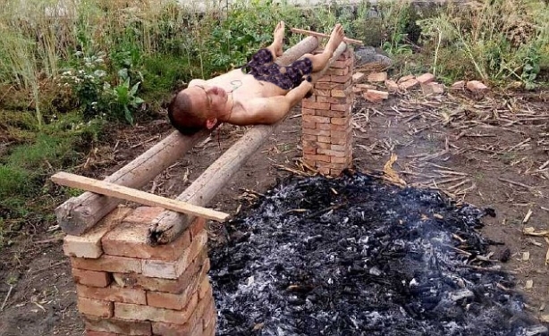 Foto - Tuhaf tedavi yöntemleri