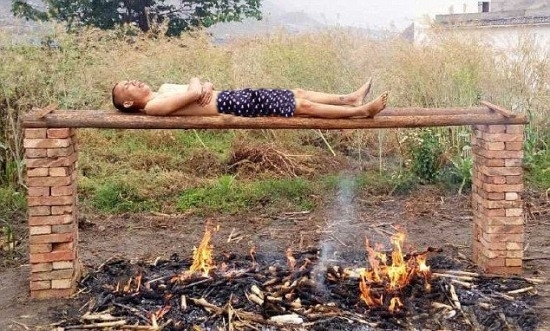 Foto - Tuhaf tedavi yöntemleri