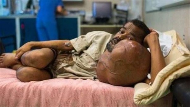 Foto - Tuhaf tıp olayları!